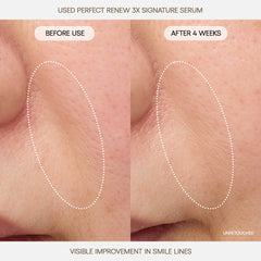 Perfect Renew 3X Signature Serum